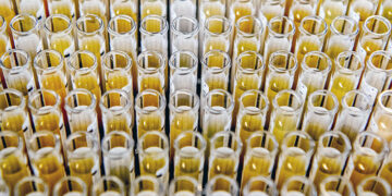 Long COVID: les scientifiques trouvent 20 «signatures» de protéines sanguines qui pourraient indiquer un risque