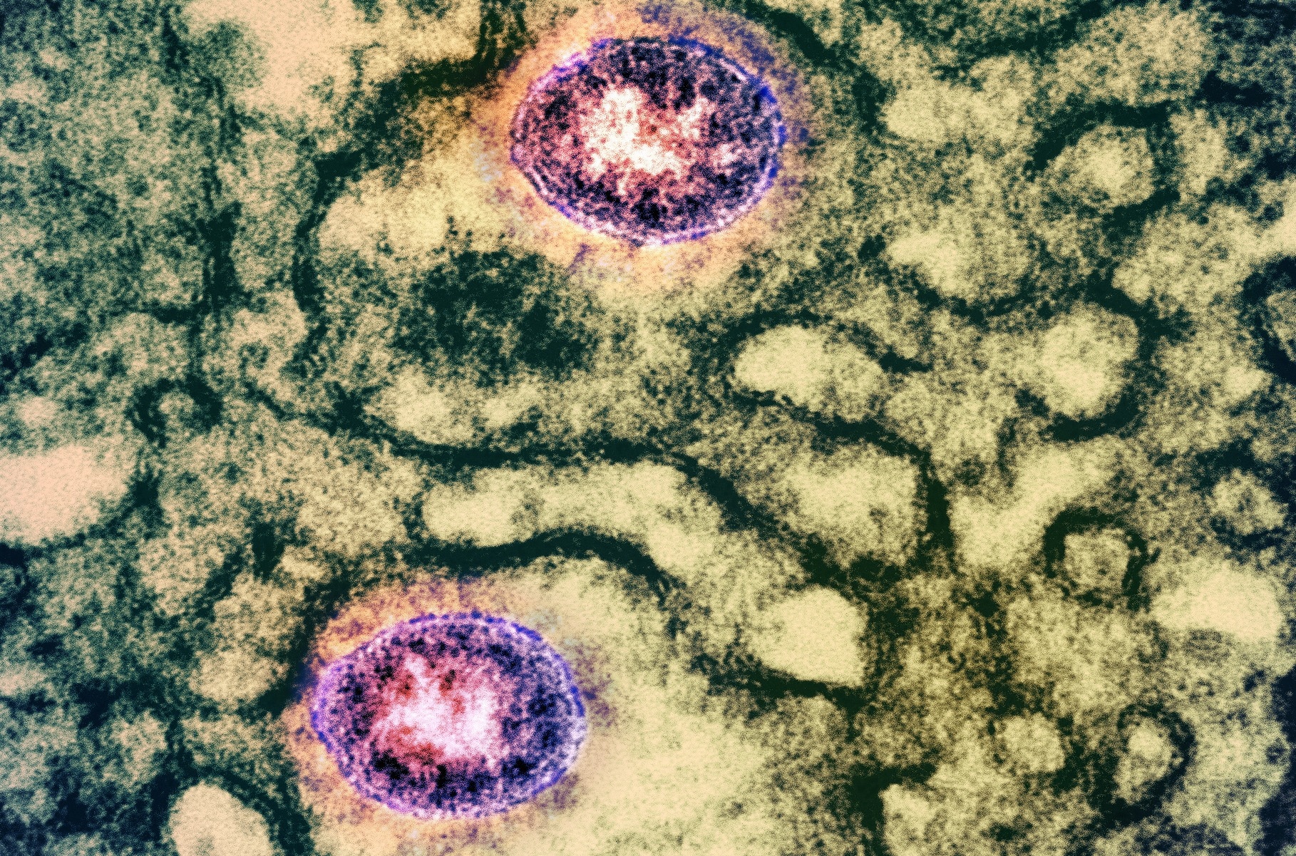 Study: Robust and rapid pipeline for the development of mRNA vaccine for the fast-emerging SARS-CoV-2 variants. Image Credit: NIAID