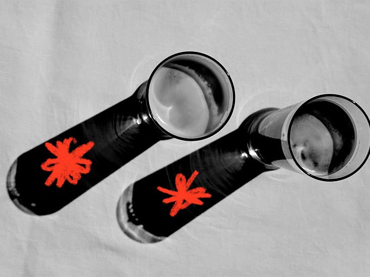 Consommation modérée à excessive d'alcool liée à un risque accru d'AVC chez les jeunes adultes