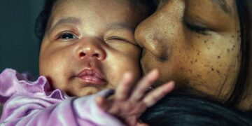 Eczéma chez les bébés : un test non invasif peut aider à prédire la dermatite atopique