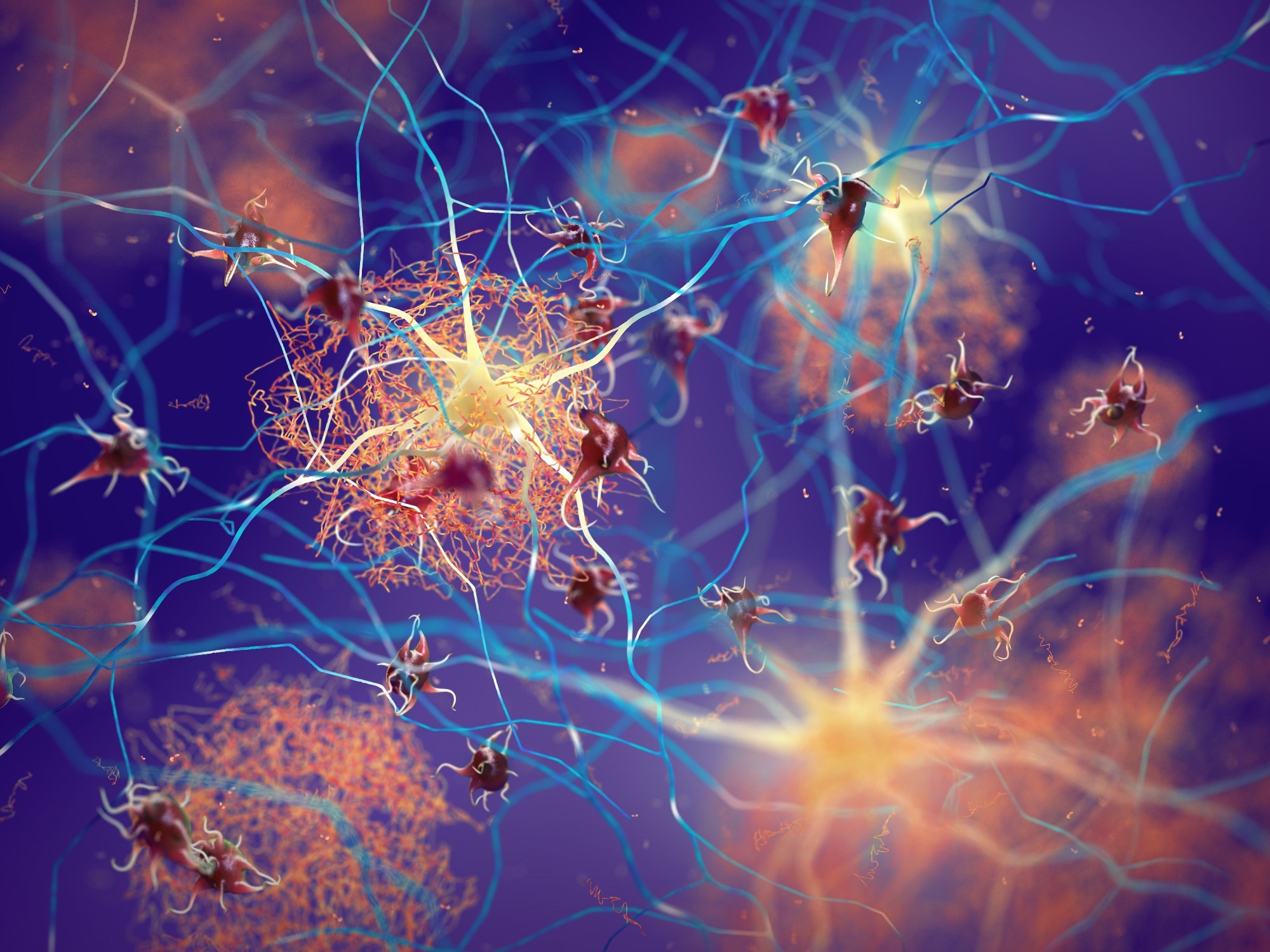 Study: Molecular and cellular similarities in the brain of SARS-CoV-2 and Alzheimer’s disease individuals. Image Credit: nobeastsofierce/Shutterstock