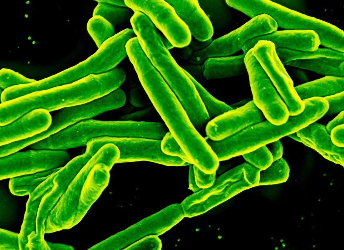 Study: Inequalities in the impact of COVID-19-associated disruptions on tuberculosis diagnosis by age and sex in 45 high TB burden countries. Image Credit: NIAID