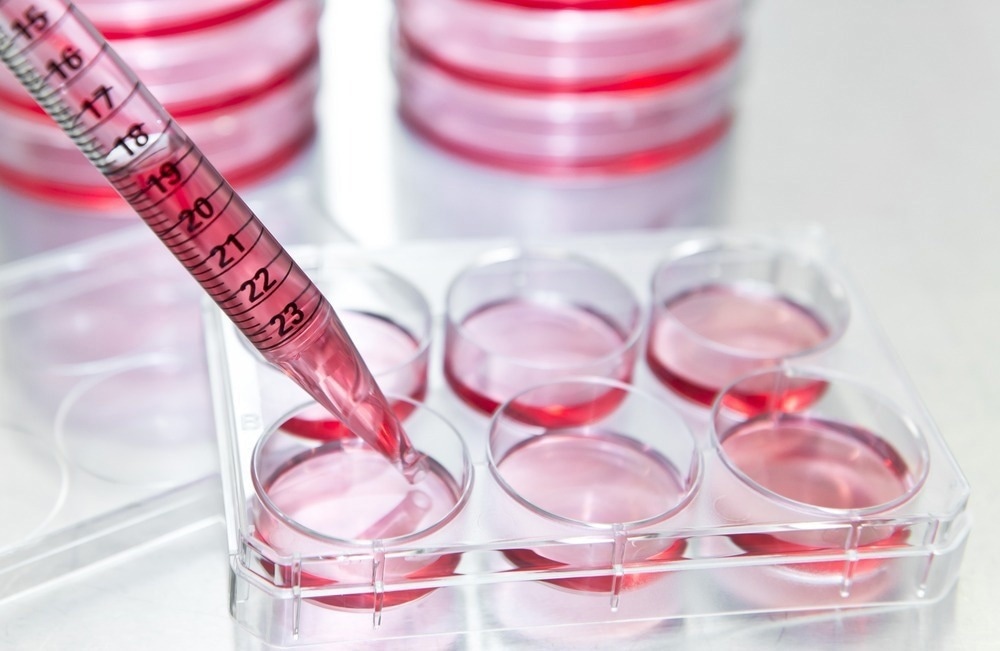 Des solutions d'analyse pré-plaquées qui peuvent aider à accélérer la biotechnologie