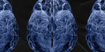 Les cellules immunitaires du cerveau pourraient combattre la maladie d'Alzheimer à ses débuts