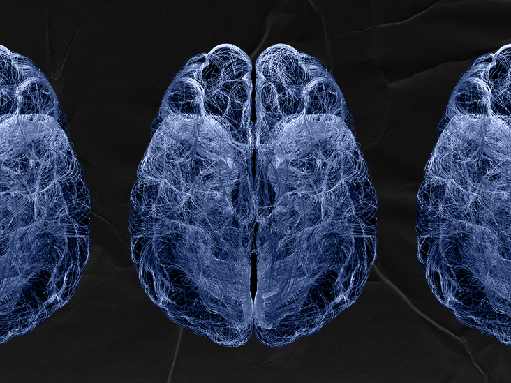 Les cellules immunitaires du cerveau pourraient combattre la maladie d'Alzheimer à ses débuts