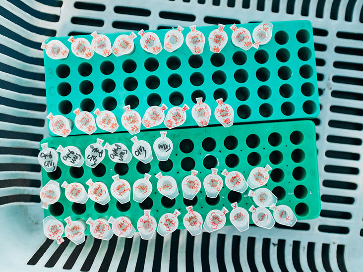 Maladie inflammatoire de l'intestin : comment un ensemble de molécules pourrait conduire à de nouveaux traitements médicamenteux contre les MII