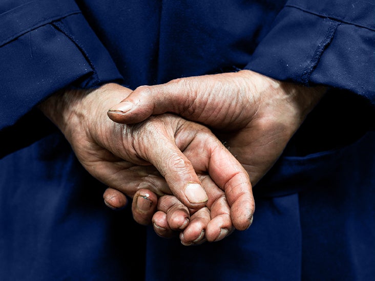 Qu'est-ce qui cause la maladie d'Alzheimer?  La recherche chez la souris indique un gonflement des axones