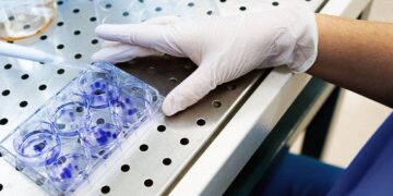 Talquetamab : un nouveau médicament peut offrir de l'espoir aux personnes atteintes d'un cancer du sang difficile à traiter