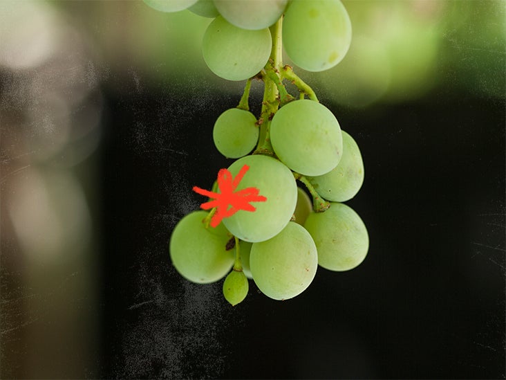 3 portions de raisins par jour peuvent réduire les risques de coups de soleil pour certaines personnes