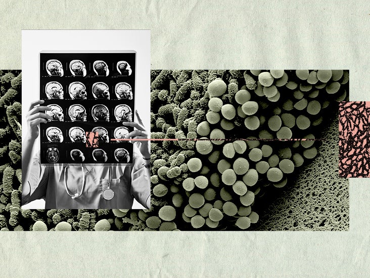 Connexion intestin-cerveau : 3 acides gras peuvent être liés à des dommages à médiation tau