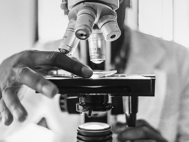Eczéma : un médicament expérimental se révèle prometteur dans le traitement de la dermatite atopique