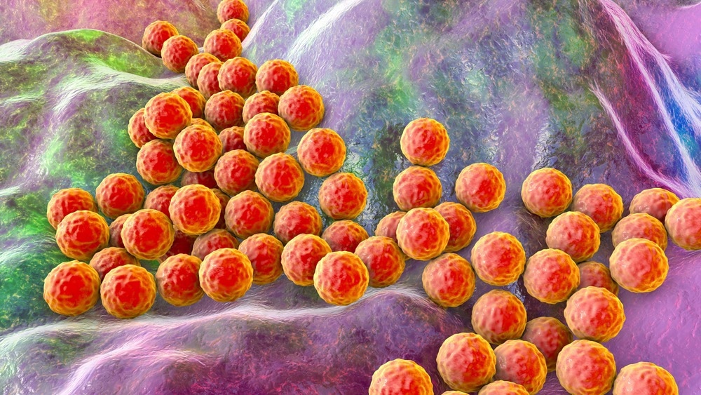 Study: Costs associated with antimicrobial-resistant infections in Canada, 2019. Image Credit: Kateryna Kon/Shutterstock