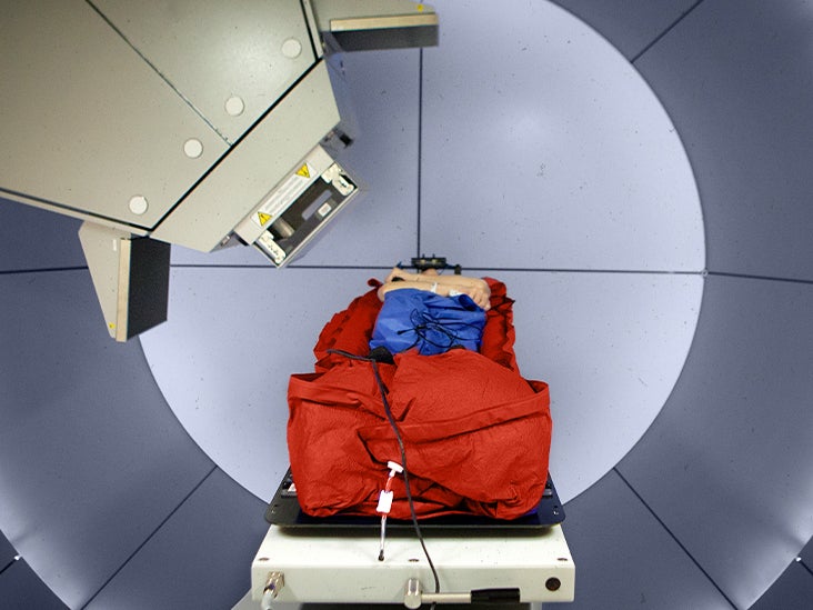 Un essai britannique demande si la protonthérapie pour le cancer du sein peut réduire les risques cardiaques