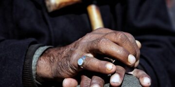 Un médicament réutilisé peut offrir un soulagement aux personnes souffrant d'arthrose de la main