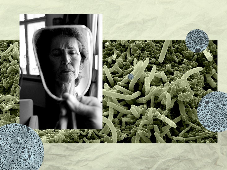 Une étude chez l'homme confirme le lien entre la maladie de Parkinson et le déséquilibre des bactéries intestinales