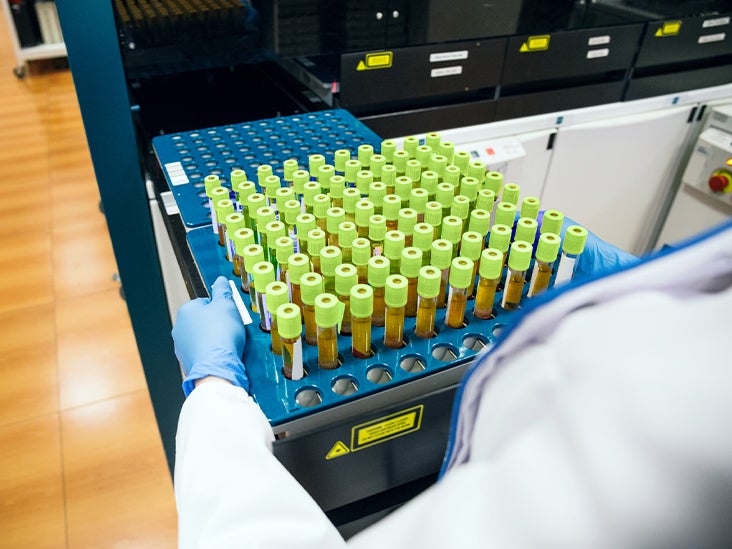 Une nouvelle combinaison de médicaments semble prometteuse pour provoquer une régression des tumeurs cancéreuses
