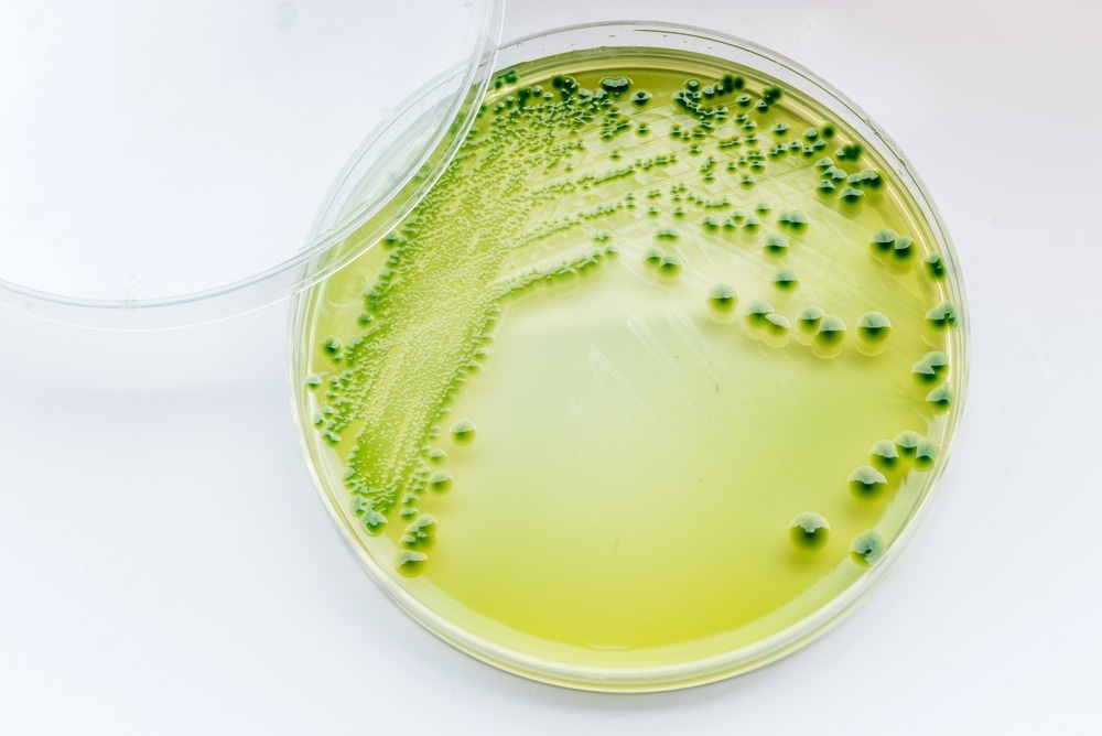 Augmentation des infections à Shigella résistantes chez les hommes ayant des rapports sexuels avec des hommes