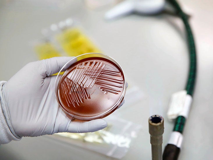 EM/SFC : comment le microbiote intestinal peut avoir un impact sur la réponse immunitaire