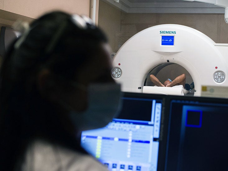 Le nivolumab améliore la survie de 80 % des participants à l'essai atteints d'un cancer du poumon commun