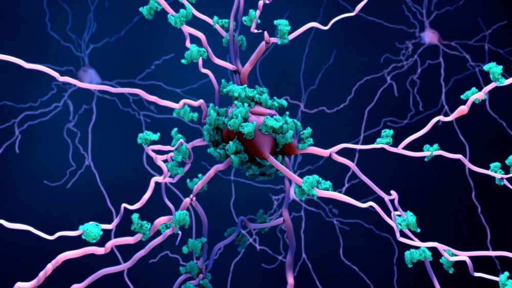 Study: Rates of regional tau accumulation in ageing and across the Alzheimer