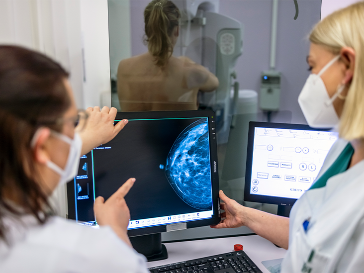 Cancer du sein : la mammographie 3D est meilleure que la numérisation 2D pour le dépistage, selon une étude