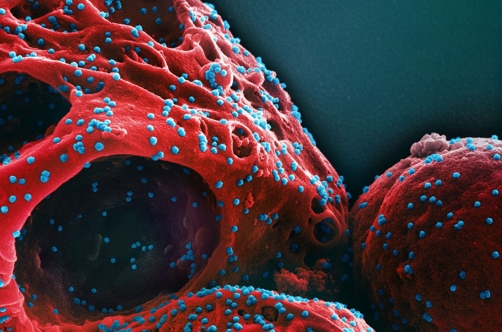 Editorial: A critical analysis of the evidence for the SARS-CoV-2 origin hypotheses. Image Credit: NIAID