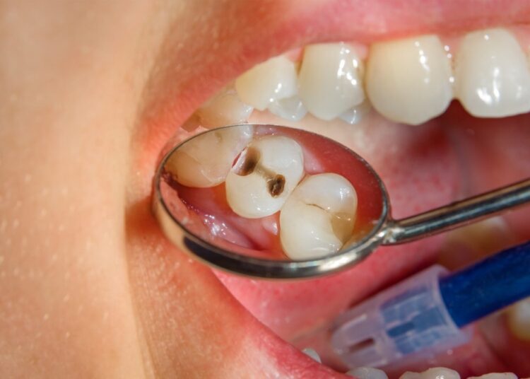 Study: Development of the oral resistome during the first decade of life. Image Credit: Sergii Kuchugurnyi/Shutterstock