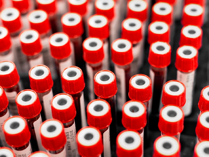 Un test de protéines peut être plus précis pour prédire les maladies cardiaques que les niveaux de cholestérol