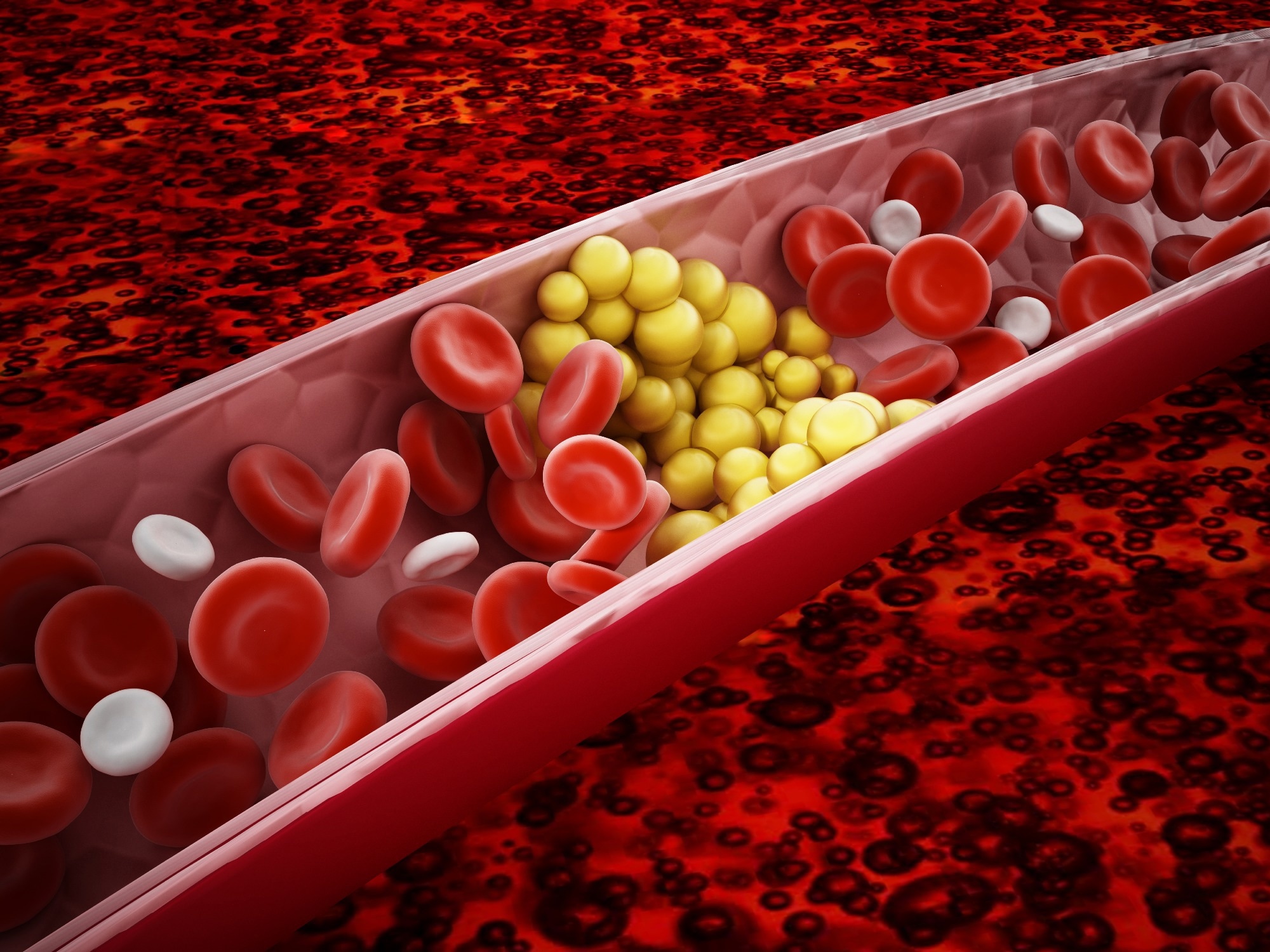 Study: Effects of short-term PM2.5 exposure on blood lipids among 197,957 people in eastern China. Image Credit: cigdem/Shutterstock