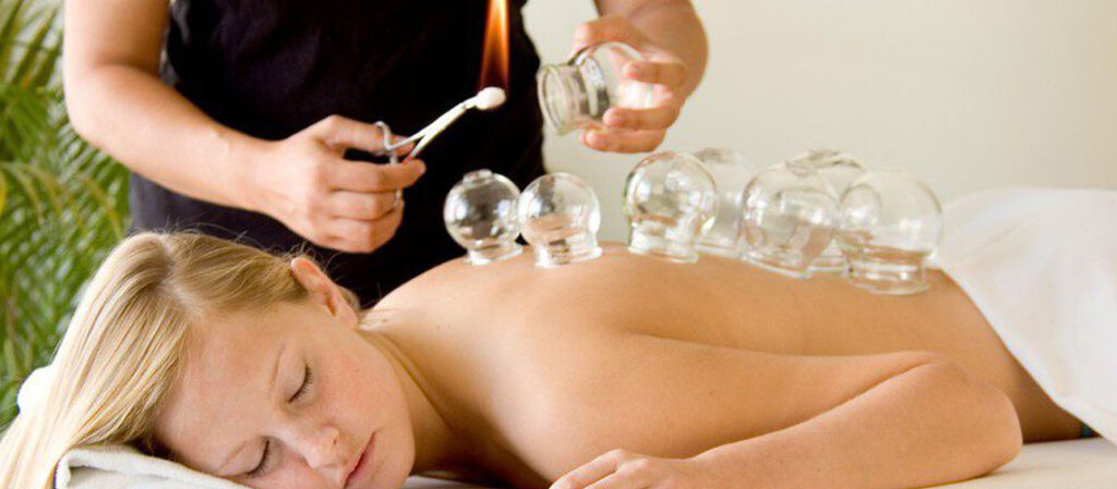La Hijama : les bienfaits de la cupping therapy