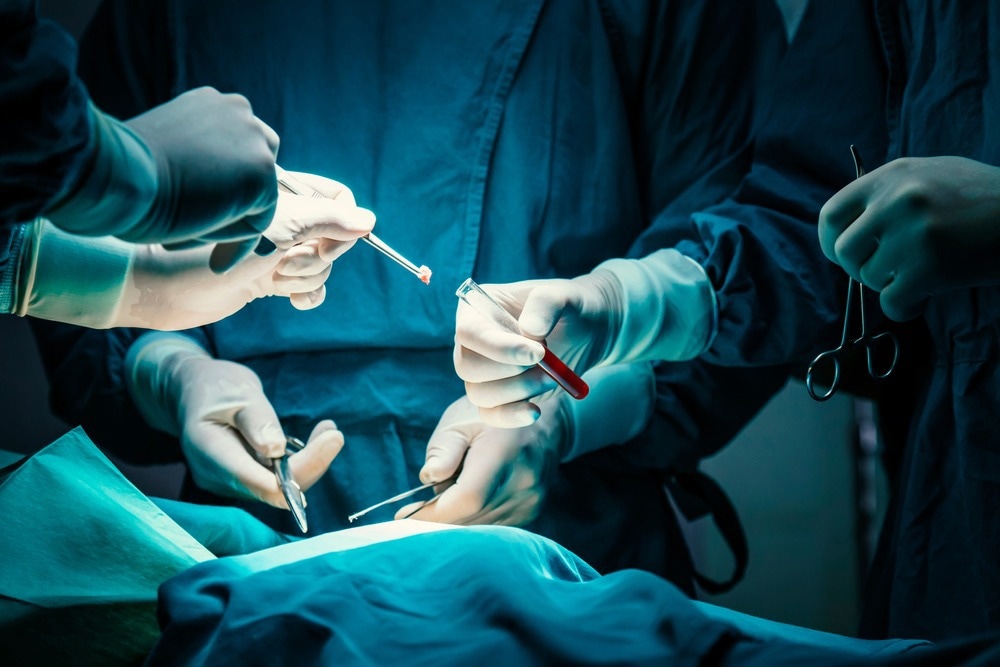 Biopsie tumorale
