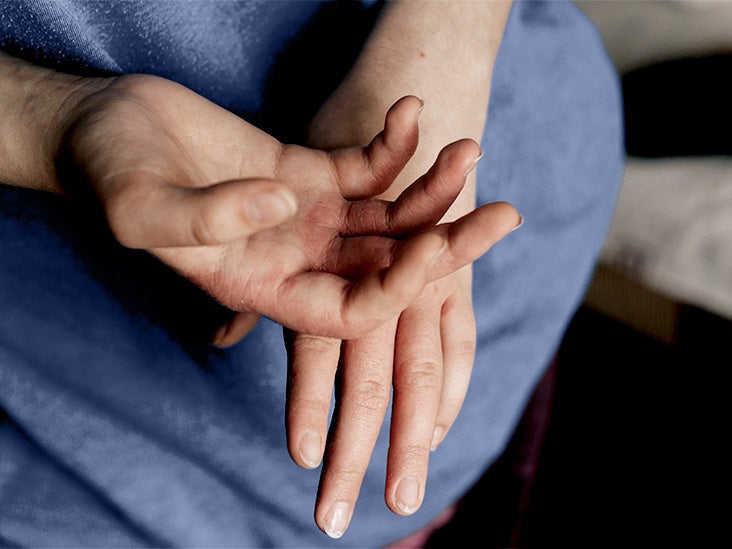 Eczéma chez les bébés : les scientifiques affirment que le biomarqueur cutané peut aider à prédire la dermatite atopique