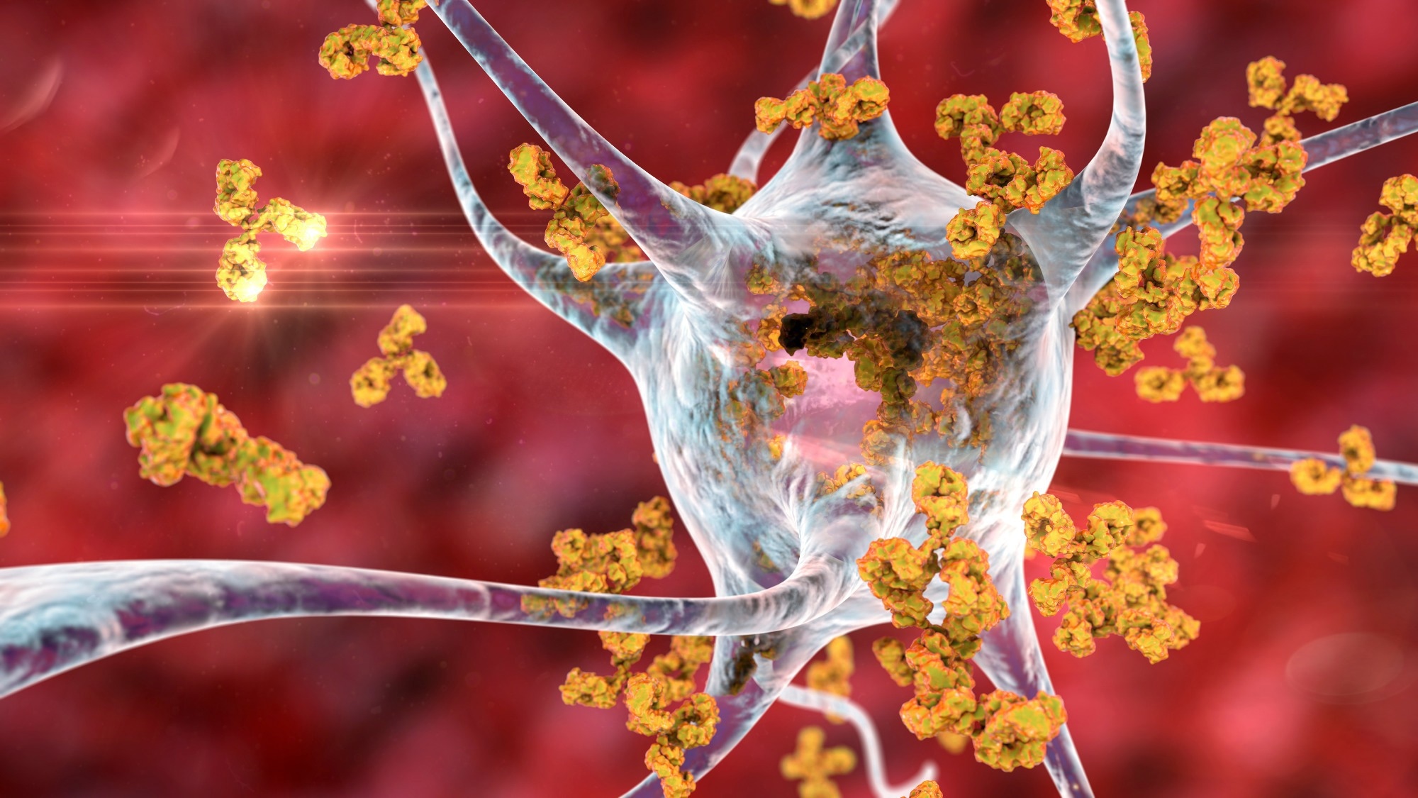 Study: High risk of autoimmune diseases after COVID-19. Image Credit: KaterynaKon/Shutterstock.com  Background