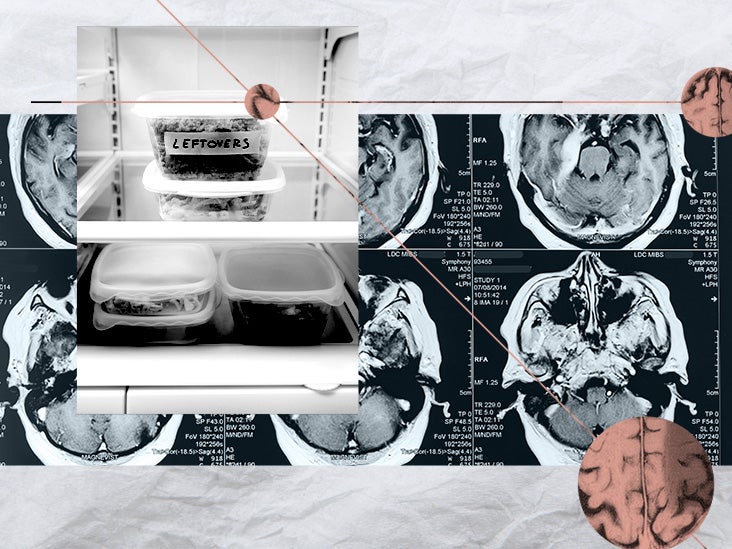 Gain de poids post-régime : une modification de la signalisation des neurones de la faim peut offrir une explication