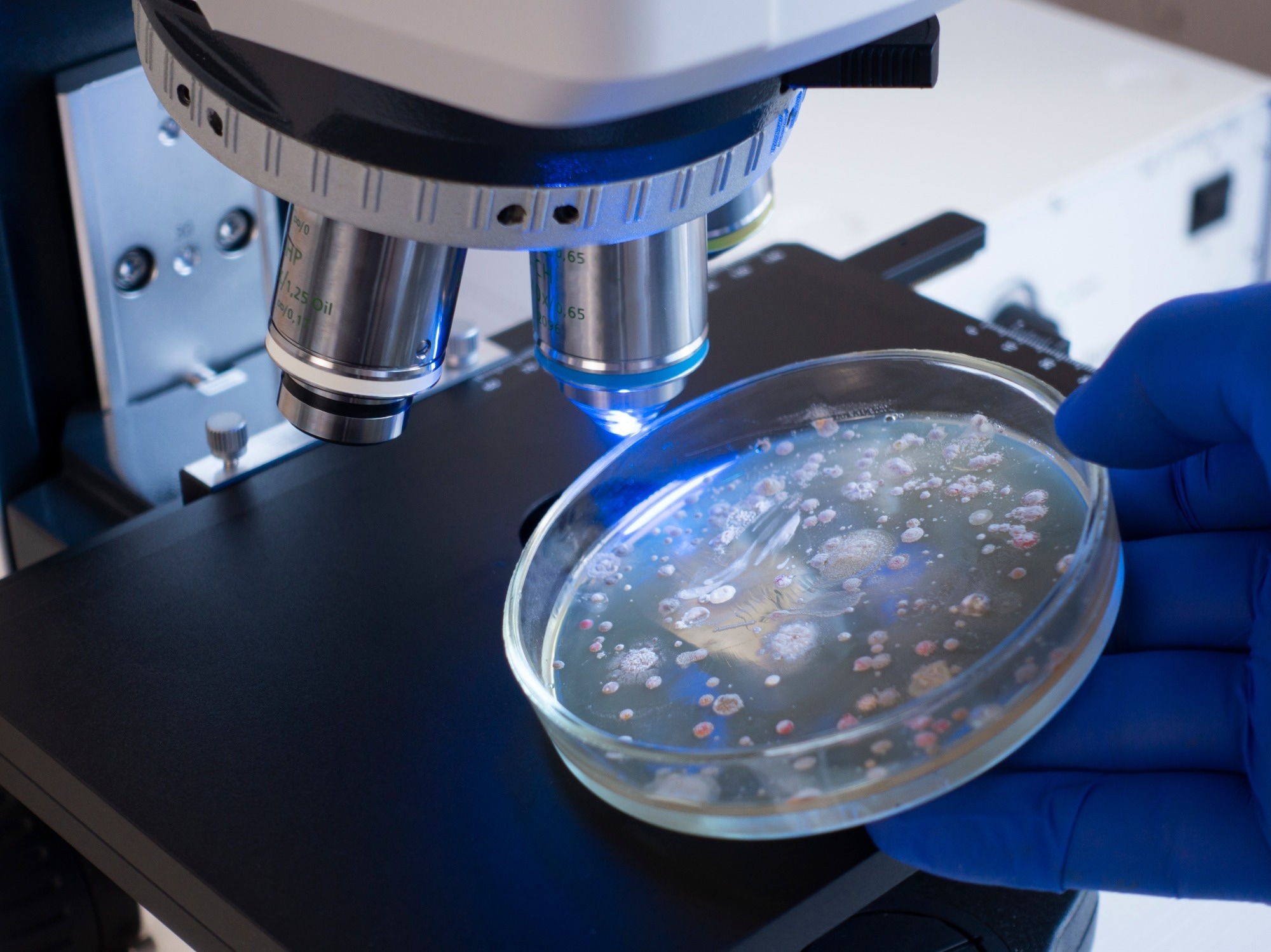 tudy: Unexpected Increase in Invasive Group A Streptococcal Infections in Children Following Respiratory Viruses Outbreak in France: a 15-Year Time-Series Analysis. Image Credit: Prrrettty / Shutterstock.com