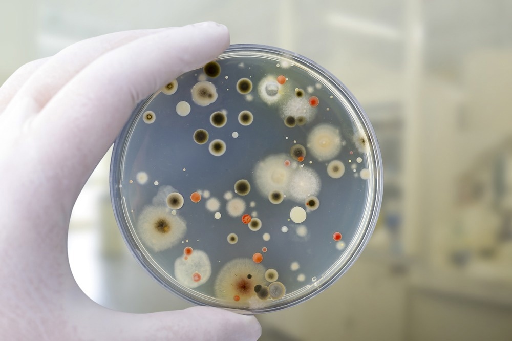 Study: Plastic pollution and fungal, protozoan, and helminth pathogens – A neglected environmental and public health issue? Image Credit: Kateryna Kon / Shutterstock.com
