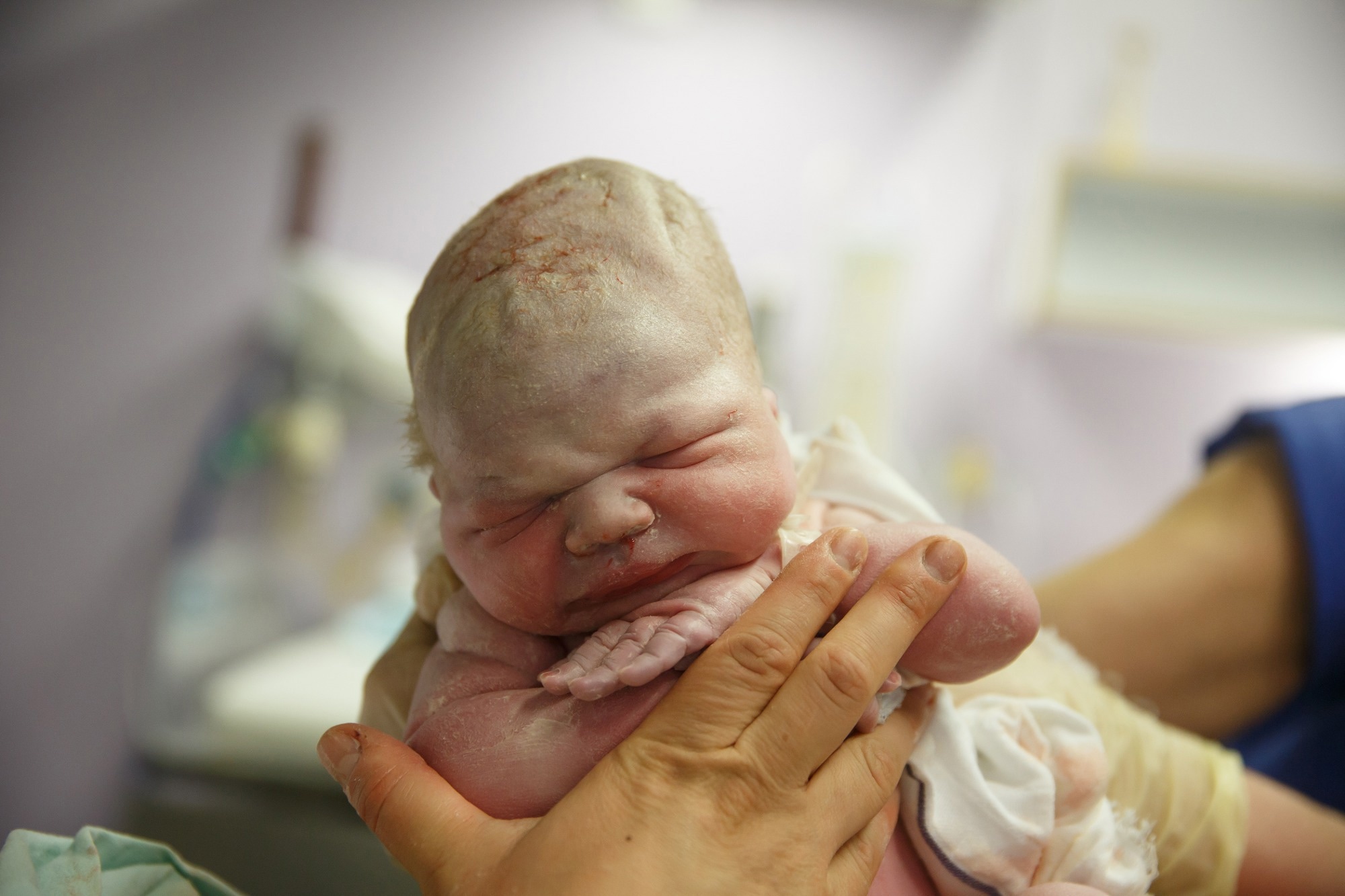 Study: Birth Weight Moderates the Association Between Obesity and Mortality Rate. Image Credit: zlikovec / Shutterstock