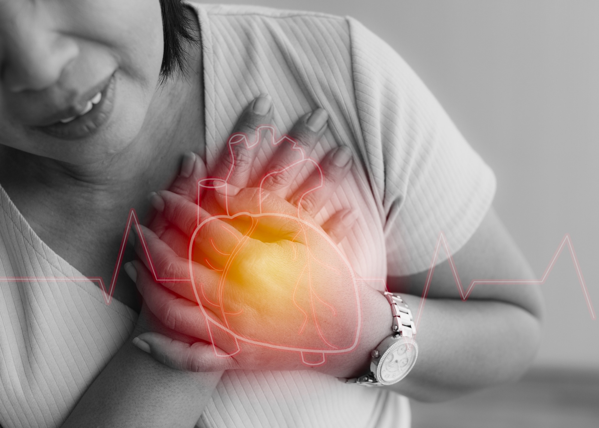 Un Risque Accru De Maladies Cardiovasculaires – XYTKFB