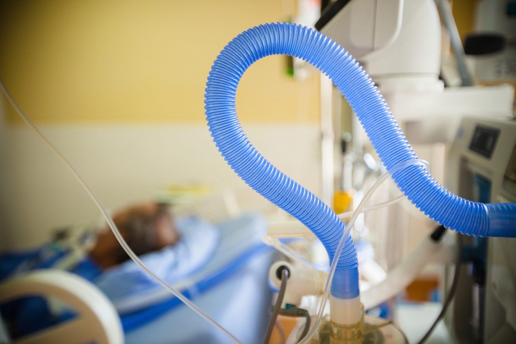 Study: Respiratory syncytial virus-related complications and healthcare costs among a Medicare-insured population in the United States. Image Credit: Chaikom / Shutterstock