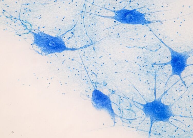 Study: OPA pheomelanin is increased in nigral neuromelanin of Parkinson’s disease. Image Credit: Rattiya Thongdumhyu / Shutterstock.com