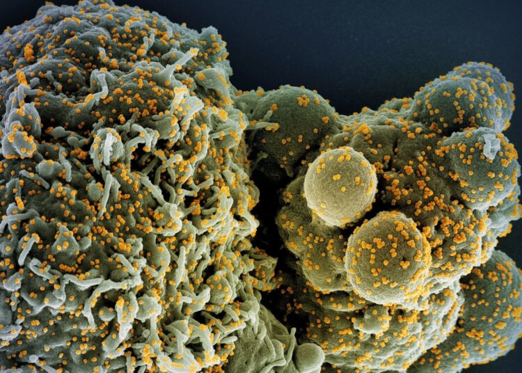 Study: A replicon RNA vaccine can induce durable protective immunity from SARS-CoV-2 in nonhuman primates after neutralizing antibodies have waned. Image Credit: NIAID