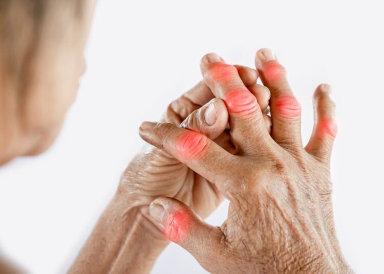 Study: Hmong microbiome ANd Gout, Obesity, Vitamin C (HMANGO-C): A phase II clinical study protocol. Image Credit: Doucefleur / Shutterstock