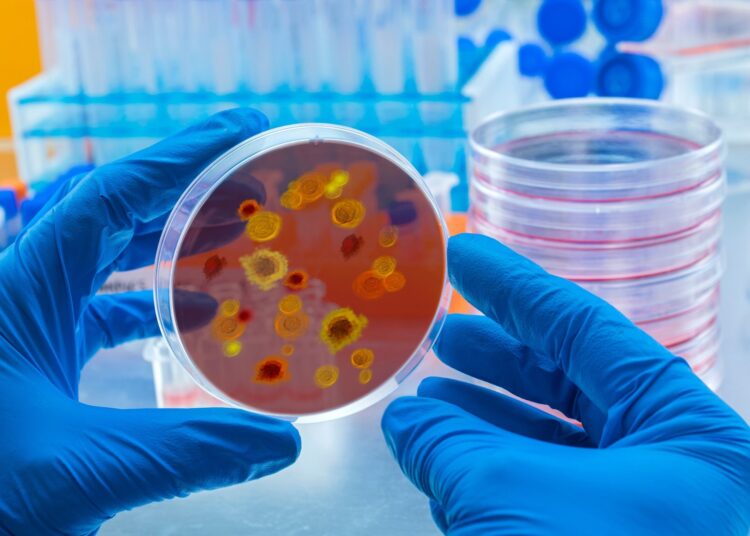 Study: CMPK2 restricts Zika virus replication by inhibiting viral translation. Image Credit: felipe caparros / Shutterstock