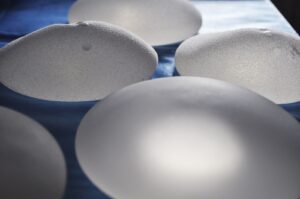 Augmentation mammaire par prothèses ou par lipofilling ?