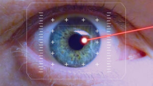 Qui a recourt à la chirurgie Lasik en 2023 ?