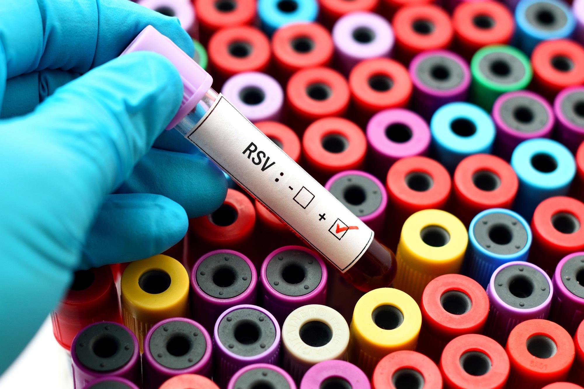 Study: Shifting Epidemiology and Severity of Respiratory Syncytial Virus in Children During the COVID-19 Pandemic. Image Credit: JarunOntakrai/Shutterstock.com
