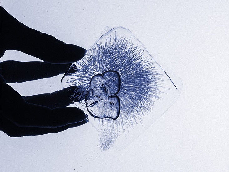 La cryostimulation corps entier pourrait-elle aider à traiter l'obésité ?