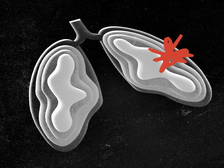 La restriction d'oxygène aide les souris à vieillissement rapide à vivre plus longtemps, rapporte une étude