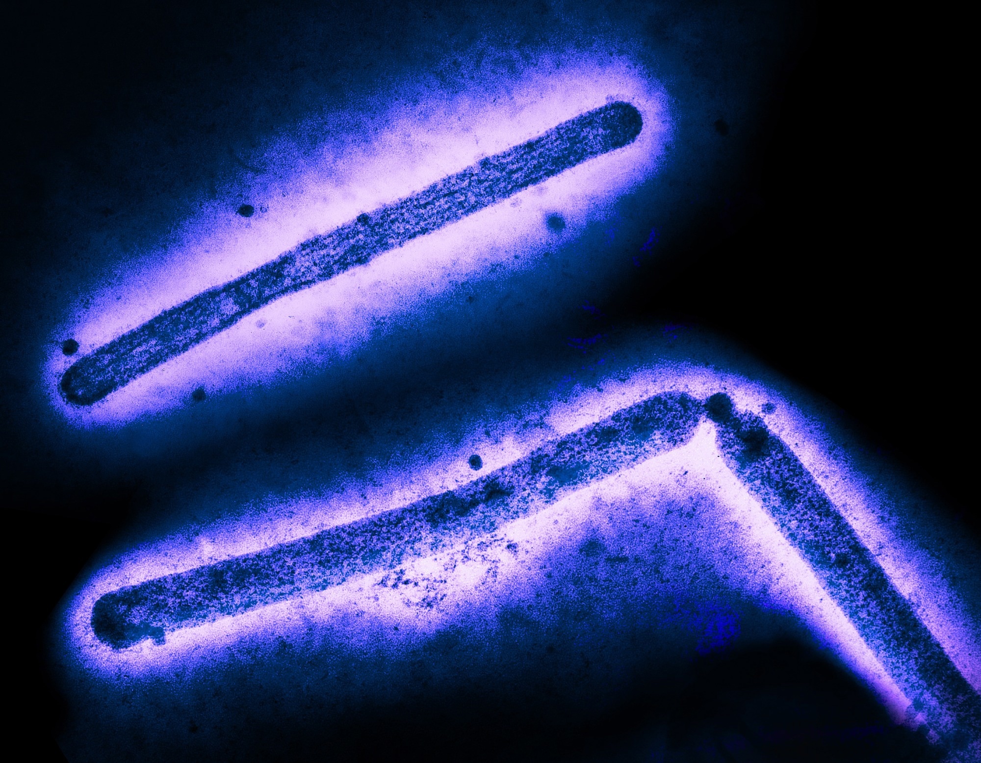 Study: Rapid evolution of A(H5N1) influenza viruses after intercontinental spread to North America. Image Credit: CDC and NIAID