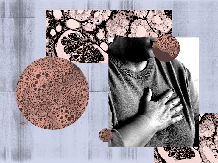 Les lésions rénales peuvent augmenter votre risque de maladie cardiaque